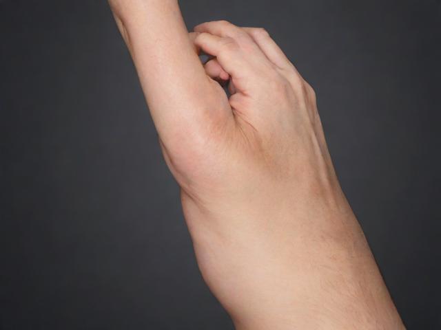 合肥哪里去狐臭好？专业解析合肥去狐臭好的选择关键！