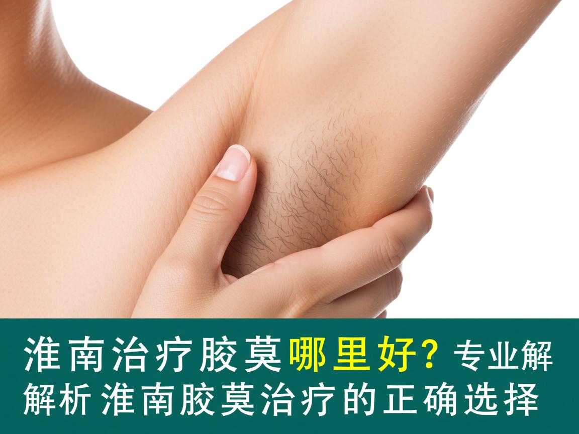 淮南治疗腋臭哪里好？专业解析淮南腋臭治疗的正确选择
