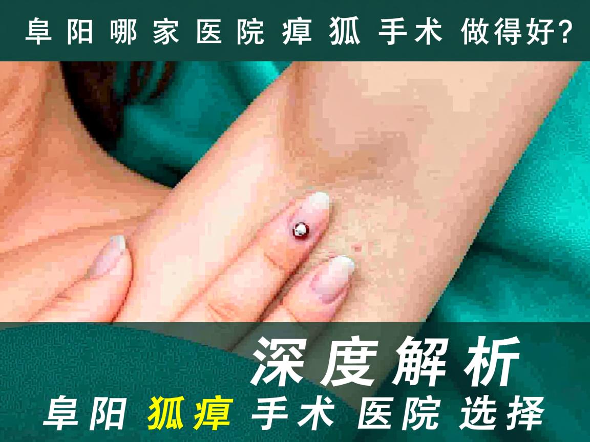 阜阳哪家医院狐臭手术做得好？深度解析阜阳狐臭手术医院选择