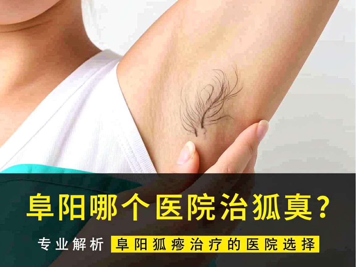 阜阳哪个医院治狐臭?专业解析阜阳狐臭治疗的医院选择 阜阳哪个医院治狐臭?专业解析阜阳狐臭治疗的医院选择