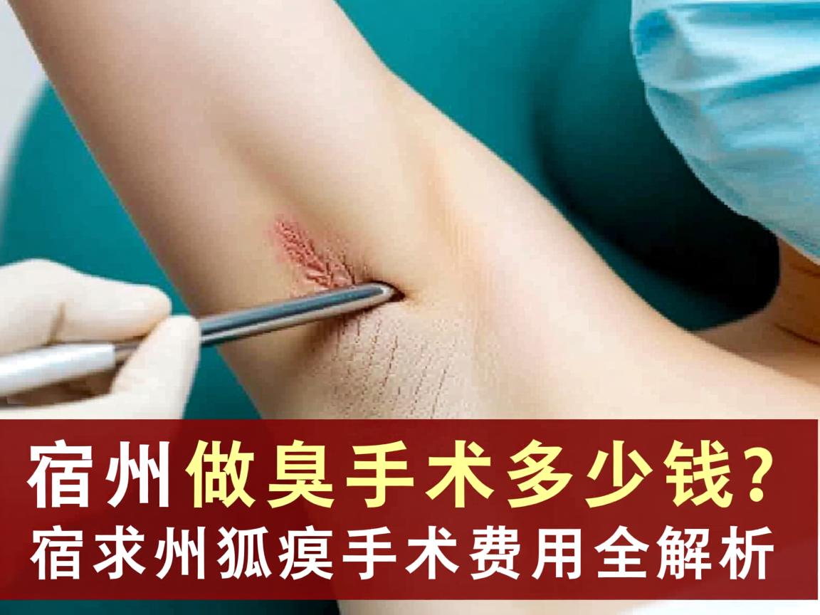 宿州做狐臭手术多少钱?宿州狐臭手术费用全解析 宿州做狐臭手术多少钱?宿州狐臭手术费用全解析