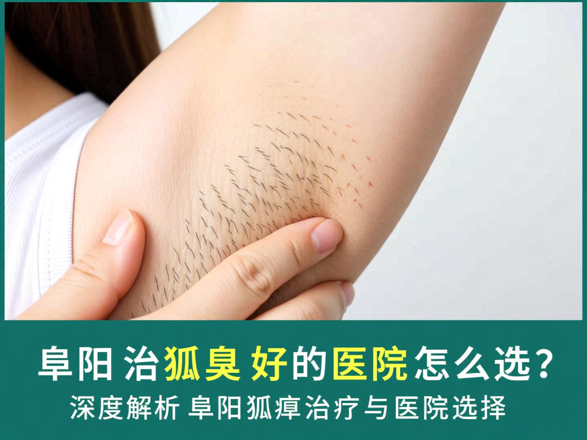 阜阳治狐臭好的医院怎么选?深度解析阜阳狐臭治疗与医院选择 阜阳治狐臭好的医院怎么选?深度解析阜阳狐臭治疗与医院选择