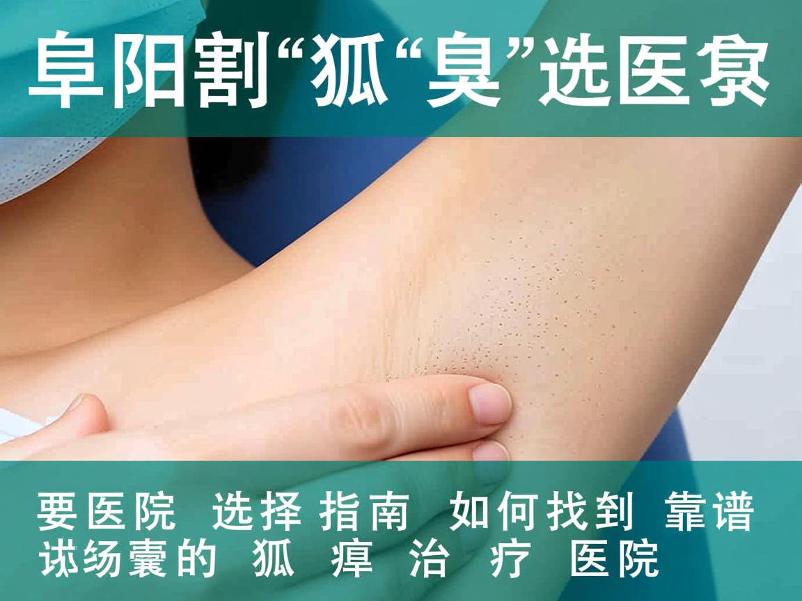 阜阳割狐臭的医院选择指南，如何找到靠谱的狐臭治疗医院