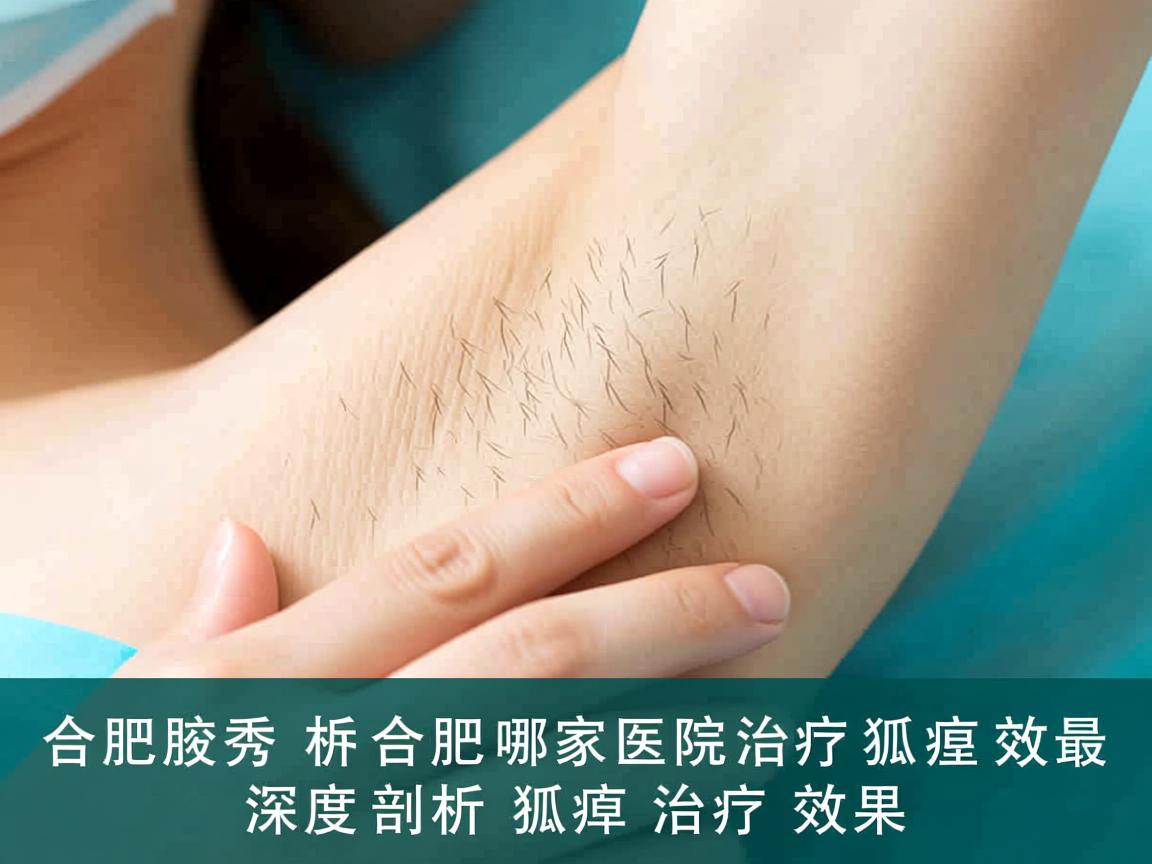 合肥腋秀解析,合肥哪家医院治疗狐臭效果最好,深度剖析狐臭治疗效果 合肥腋秀解析,合肥哪家医院治疗狐臭效果最好,深度剖析狐臭治疗效果