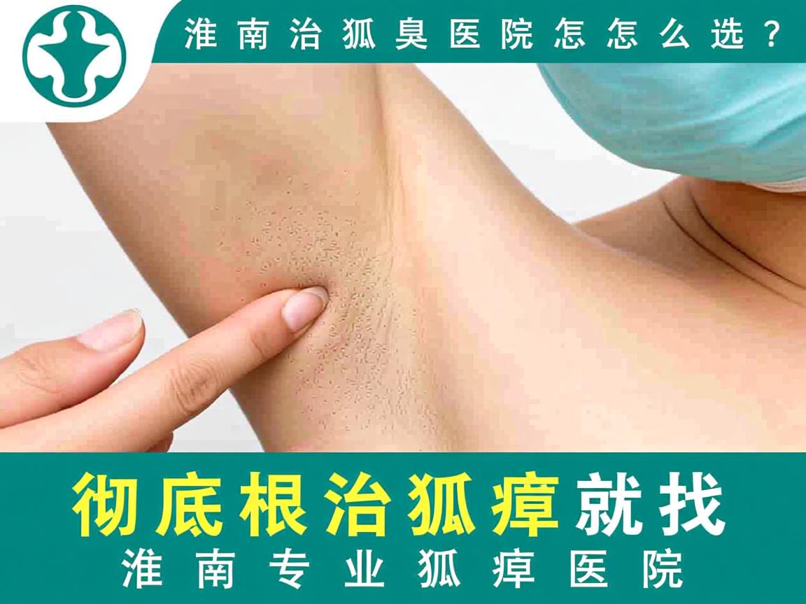 淮南治狐臭医院怎么选？彻底根治狐臭就找淮南专业狐臭医院