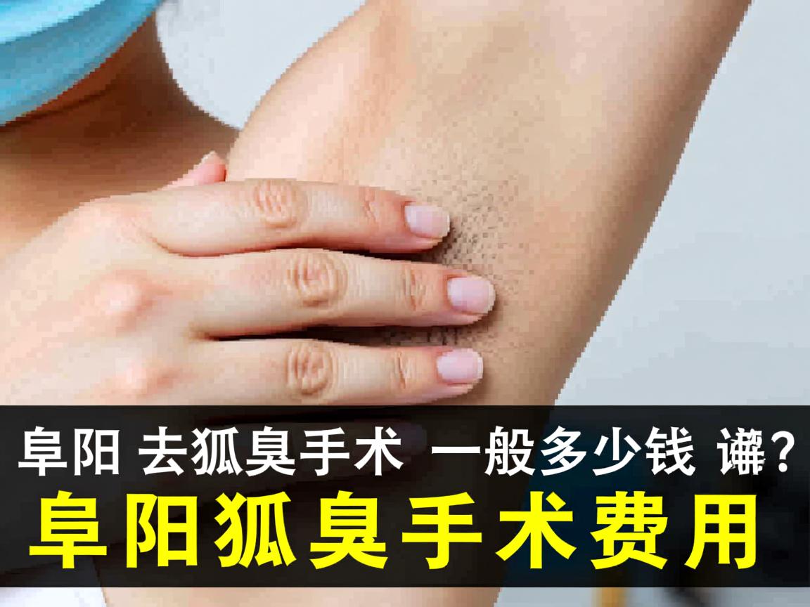 阜阳去狐臭手术一般多少钱?详解阜阳狐臭手术费用 阜阳去狐臭手术一般多少钱?详解阜阳狐臭手术费用